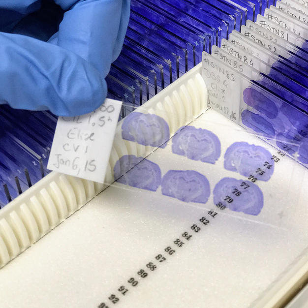 Gloved hand holding research samples.