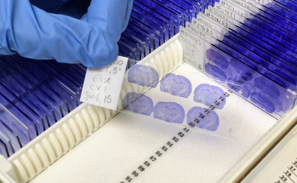 Gloved hand holding research samples.