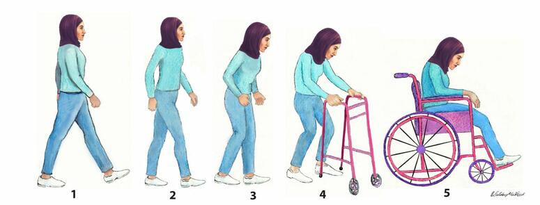An image depicting the five stages of Parkinson's disease progression in women.