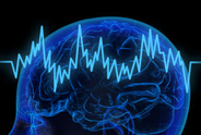 Brain scan
