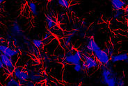 astrocyte.jpg