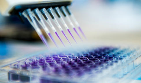 Tests for Parkinson's within Reach