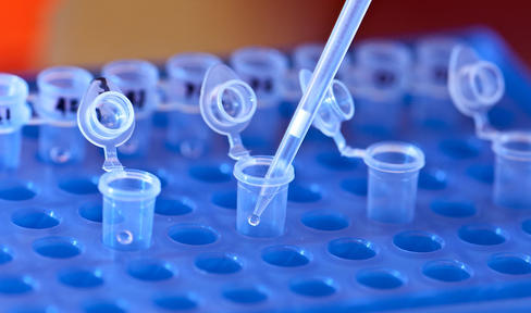 Genetic testing