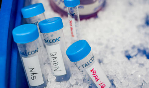 What We Fund: Parkinson’s Skin Test, Antioxidant Treatment and Brain Change Tracking