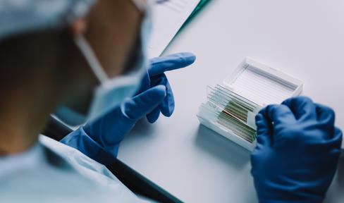 Scientist examining samples