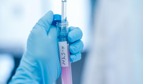Gloved hand holding test tube with alpha-synuclein on label