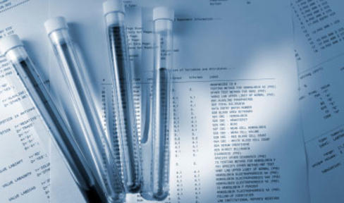 First Paper Featuring PPMI Data Is Published