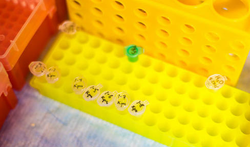 Could MAO-B Inhibitors Slow Parkinson's Disease Progression?