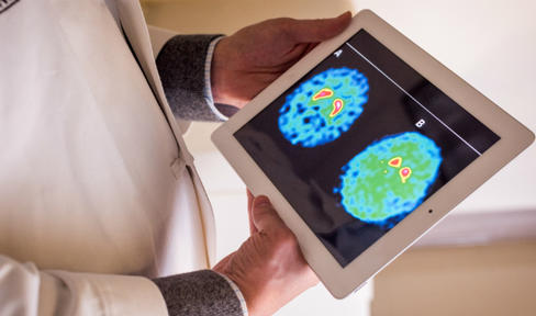 Brain Scan on Tablet