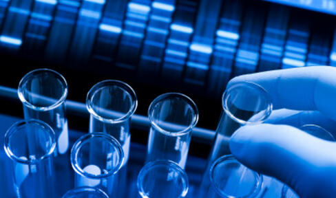Gloved fingers holding a test tube in front of a genetic screening panel.