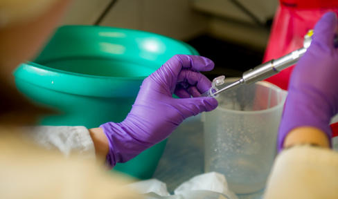 Inhaled Levodopa Resubmitted to FDA for Review