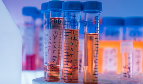 Lab Tubes