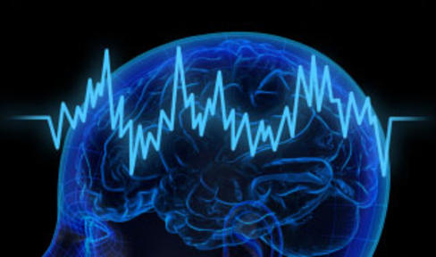 Brain scan