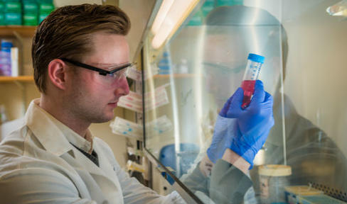 Fox Trial Finder Expands to Accelerate Research in Atypical Parkinsonism