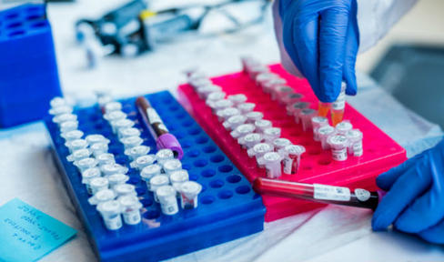 Genetic Mutation Links Parkinson's and Crohn's Disease