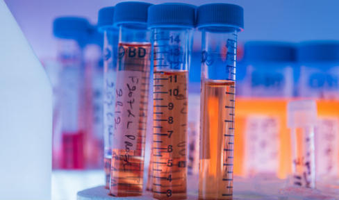 What We Fund: $6 Million in New Grants for Parkinson’s Research
