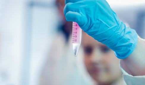New Findings Add to Evidence of Immune System Role in Parkinson's Disease
