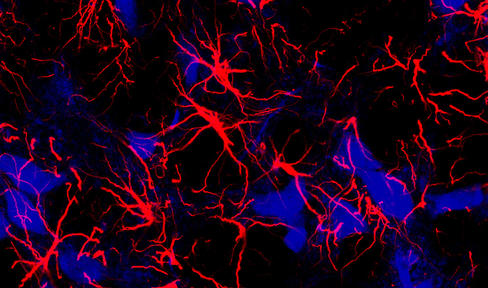 astrocyte.jpg