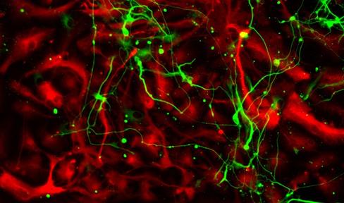 Differentiated neural stem cells