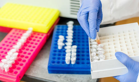 Stem Cells Safe in Pre-Clinical Parkinson's Disease Study