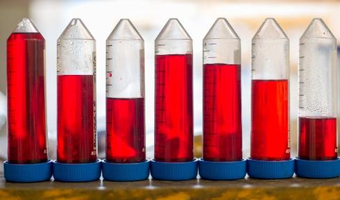 A Note from Our CEO: The Road to a Parkinson's Disease Cure