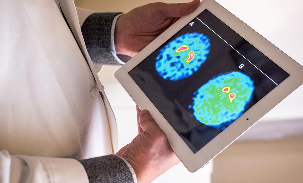 Researcher holding a tablet with brain scan.