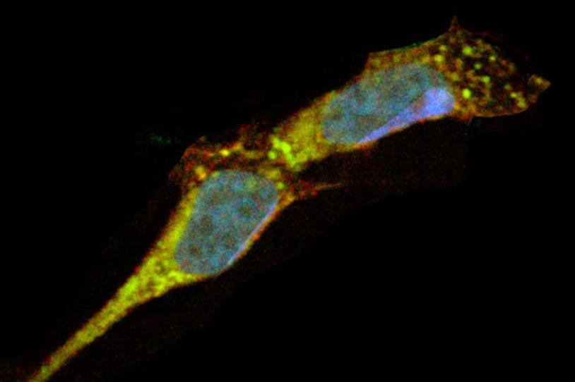 LRRK2 Cells