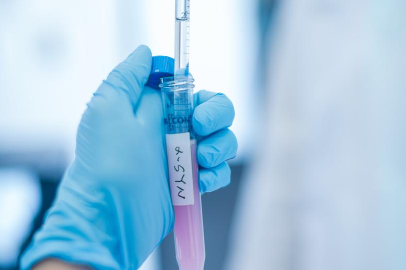Gloved hand holding test tube with alpha-synuclein on label