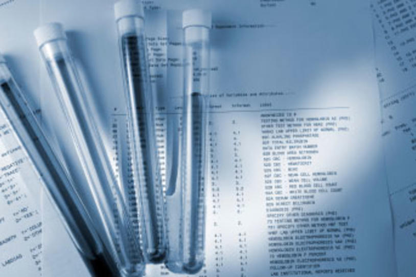 Merck to Discontinue Parkinson’s Drug Program Targeting the Brain Chemical Adenosine