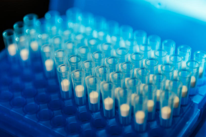 Framework Categorizes Alzheimer's to Speed Understanding and Drug Development