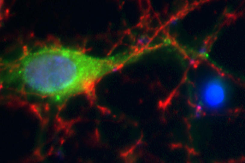 Supreme Court Rules Human Genes Are Not Patentable