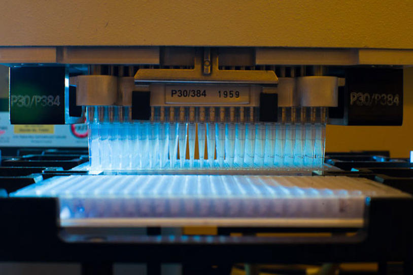 Small Setback in Promising PD Therapeutic Therapy, Rytary