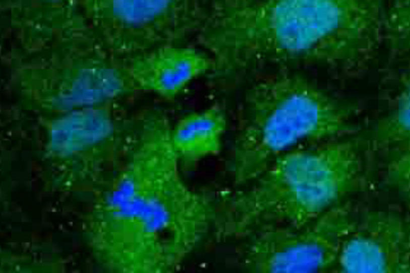 Early Stage Clinical Trial Finds Novel Drug Improves Parkinson’s Symptoms
