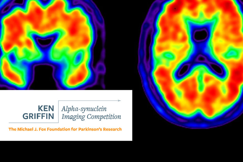 Ken Griffin Alpha-Synuclein Imaging Competition 