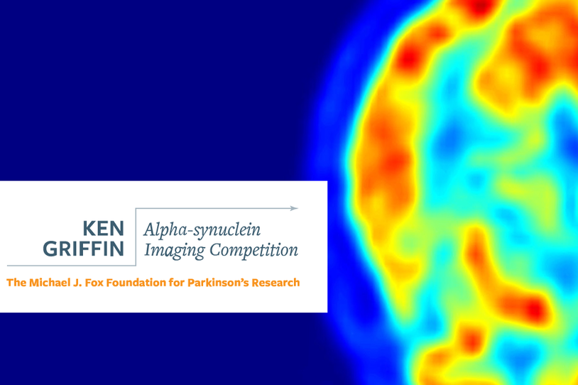 Ken Griffin Alpha-Synuclein Imaging Competition B