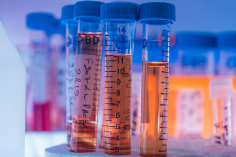 Lab Tubes