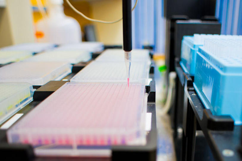 New Research Suggests Alzheimer’s Might Be ‘Type 3 Diabetes’