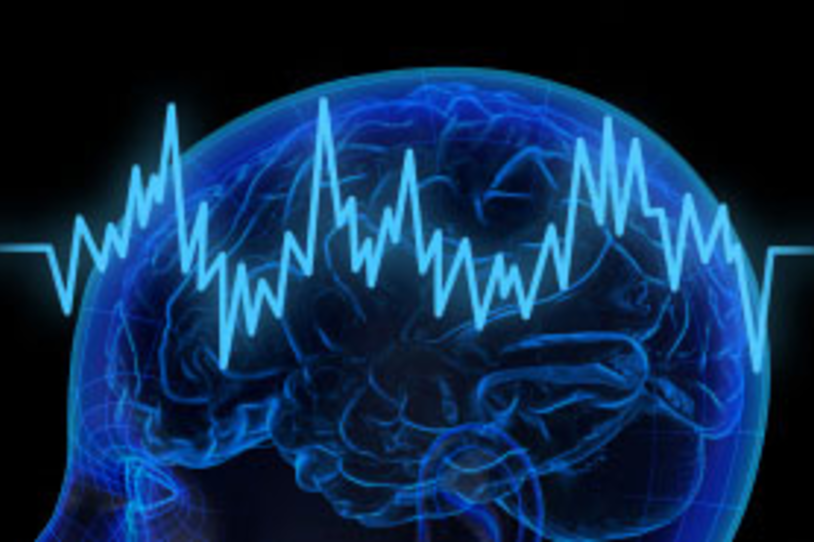 Brain scan