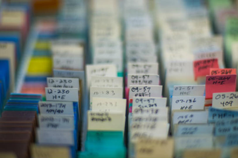 Netherlands Study Aims to Profile Parkinson's Variability