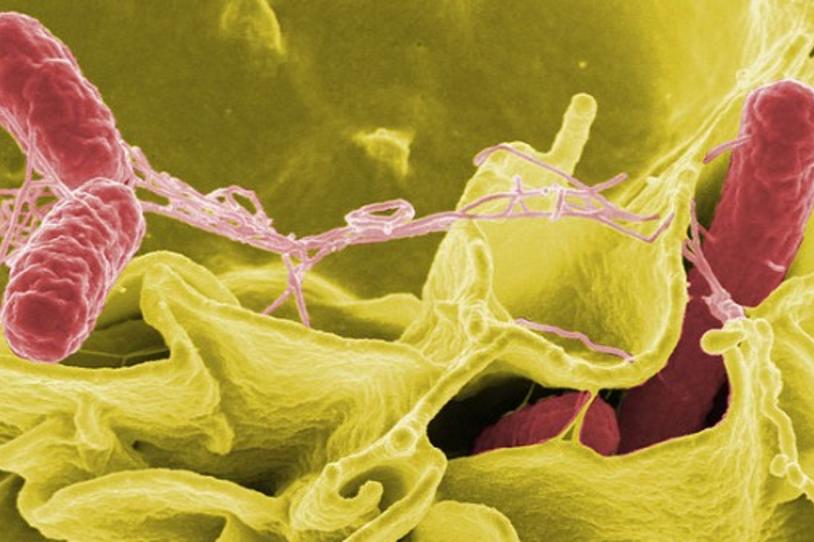 Gut Check on Parkinson's: New Findings on Bacteria Levels