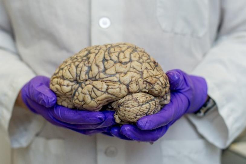 Does 90 Percent of Our Brain Go Unused?