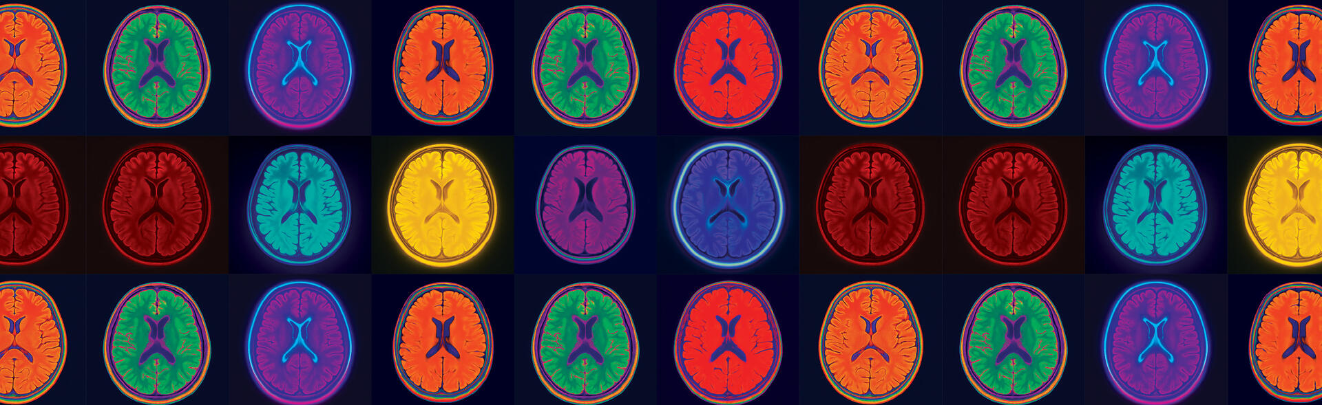 brain images