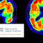 Ken Griffin Alpha-Synuclein Imaging Competition 
