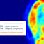 Ken Griffin Alpha-Synuclein Imaging Competition B