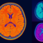 High-Res Colorful scan of a brain
